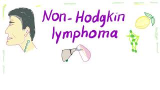 NonHodgkins lymphoma NHL Bcell and Tcell  Aggressive and Indolent [upl. by Selym472]