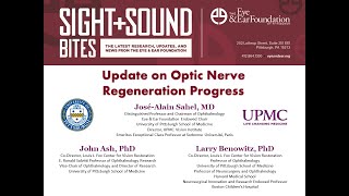 Sight  Sound Bites Update on Optic Nerve Regeneration Progress [upl. by Gavra]