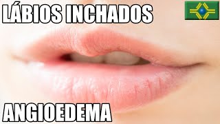 LÁBIOS INCHADOS  ANGIOEDEMA HEREDITÁRIO  Quais exames fazer [upl. by Aivatnahs]