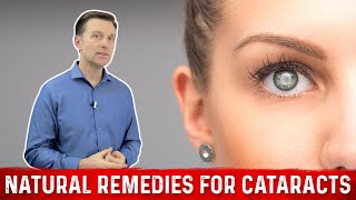 How to Prevent Cataracts With Natural Remedies – Dr Berg [upl. by Roxanne]