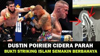 MENGERIKAN  STRIKING ISLAM MAKHACHEV BIKIN DUSTIN POIRIER CIDERA PARAH  BERITA UFC TERBARU [upl. by Malissia314]