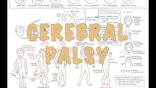 Cerebral Palsy  DETAILED Overview [upl. by Nacul102]