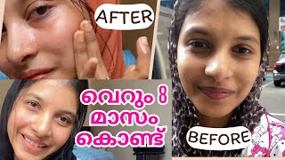 💯😳quotഎങ്ങനെ ഇത്ര glow ആയി quot My skin care products  Selmadinash [upl. by Adniled]