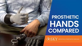 Prosthetic Hands Compared [upl. by Inanuah]