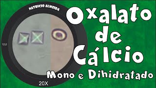 Cristais de oxalato de cálcio monohidratado e dihidratado [upl. by Itsrejk]