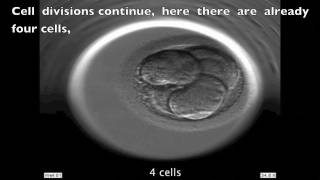 INSTITUT MARQUÈS  Development of a human embryo seen with Embryoscope [upl. by Nosnirb]