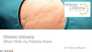 Chronic Urticaria What I Wish My Patients Knew [upl. by Settera]