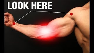 How to Fix Elbow Pain ONE SIMPLE EXERCISE [upl. by Cerell]