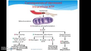 What causes Cell Injury What are the mechanisms of cell injury [upl. by Gabler370]