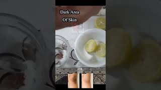 How to lighten dark skin on body  Treatment options for dark skin on body  skincare darkskin [upl. by Yesdnyl]