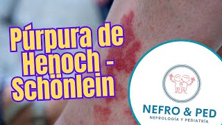 Púrpura de Henoch  Schönlein  Vasculitis por IgA  purpuradehenoch vaculitisleucocitoclastica [upl. by Pail]