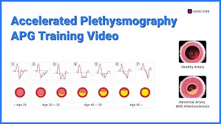 Accelerated Plethysmography  APG Training Video [upl. by Marasco790]