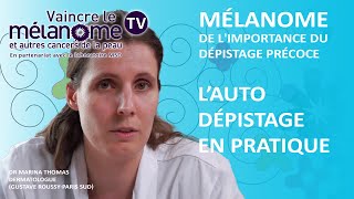 Vaincre le mélanome  Lautodépistage en pratique [upl. by Yetnom]