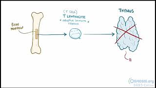 Digeorge Syndrome Osmosis [upl. by Albie915]