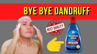 DANDRUFF PAANO MAWALA IN JUST A WEEK  Selsun Blue ProX AntiDandruff Shampoo  Honest Review Tips [upl. by Sholem993]