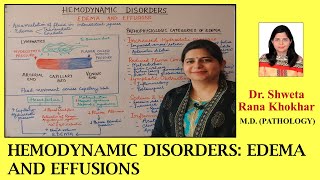 EDEMA AND EFFUSIONS  Pathophysiologic categories of edema  HEMODYNAMIC DISORDERS [upl. by Amieva]