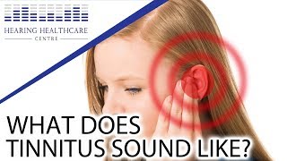 What Does Tinnitus Sound Like [upl. by Alikahs]