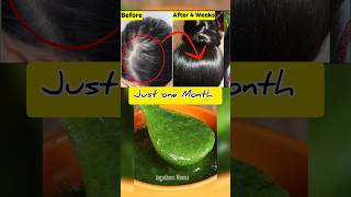 😱உங்க தலையில் முடி இல்லையா Just One Month 🔥Get New Hair😱 baldness tips [upl. by Scharff134]