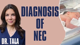 LABS Xrays physical exam findings and pertinent history used in DIAGNOSIS of NEC PART II [upl. by Robina425]