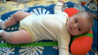 Evan six months infantile spasms  West Syndrome [upl. by Noivad]