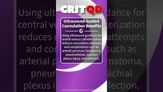 UltrasoundGuided Cannulation Benefits [upl. by Adnilrev859]