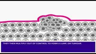 How Cancer Develops amp Mutation [upl. by Hotchkiss]