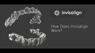 Invisalign clear aligners  how it works  wwwbangkokbracescom [upl. by Bohun687]