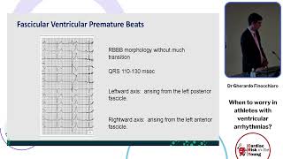 When to worry in athletes with ventricular arrhythmias  Dr Gherardo Finocchiaro [upl. by Leumel]