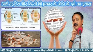 Miraculous Treatment of Arthritis Knee Joint Pain Fever Pain By Rajiv Dixit Ji [upl. by Woolson]