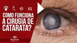 Como funciona a cirurgia de catarata  Dr Marcos de Castro Oftalmologia [upl. by Averil]