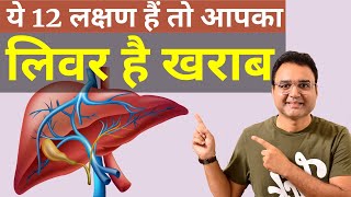 लिवर खराब होने के 12 शुरूआती लक्षण  Symptoms Of Liver Damage  by Dr Saleem Zaidi [upl. by Tressia]