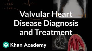 Valvular heart disease diagnosis and treatment  NCLEXRN  Khan Academy [upl. by Scopp7]