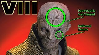 Snokes INJURIES and SCARS Explained  Star Wars The Last Jedi Explained [upl. by Enerod817]