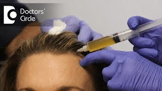 Advantages of Platelet Rich Plasma therapy PRP for hair  Dr Aruna Prasad [upl. by Enrica]