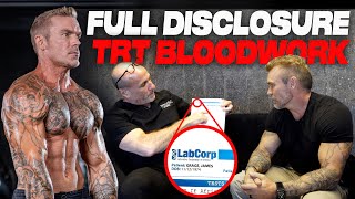 My TRT  Testosterone Protocol Reviewed by Doctor Free Testosterone SHBG DHT Estradiol amp More… [upl. by Anegroeg]