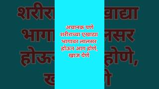 अंगावर खाज येणेलालसर चट्टेआग होणेhealthऔषधगोळीreactionरिएक्शनफोड aagskincareinflammation [upl. by Tews67]