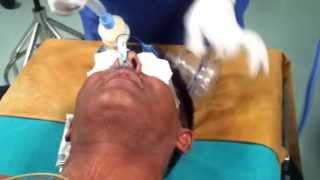 How to insert a nasogastric tube for NG intubation  3d animation [upl. by Kimberli555]