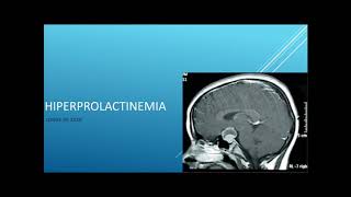 Hiperprolactinemia Tumor hipofisario [upl. by Scholem]