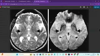 RADIOLOGY EXAM CASES [upl. by Melinda]