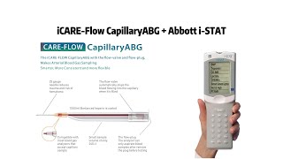 Radial ABG Sampling and testing with Abbott iSTAT POCT Analyzer [upl. by Un544]