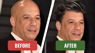 Unlocking the Secrets of Baldness Tips amp Treatments [upl. by Anrapa366]