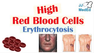 High Red Blood Cells Erythrocytosis  Causes Signs and Symptoms and Treatment [upl. by Yllrebmik683]