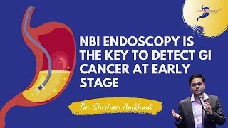 Having an Endoscopy NBI Endoscopy is the better choice [upl. by Gabie]