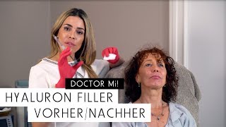 Hyaluron Filler Vorher  Nachher  DOCTOR MI Folge 9 [upl. by Aneertak670]