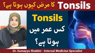 Gale Ke Tonsils k ilaj  Tonsils Treatment Causes amp Symptoms  How To Treat Tonsils [upl. by Sidras]