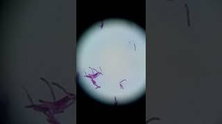 Acid fast bacilli in ZN stain [upl. by Aylward615]