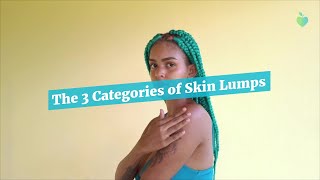 The 3 Categories of Skin Lumps [upl. by Aehsa593]