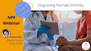 Diagnosing Psoriatic Arthritis [upl. by Riorsson]