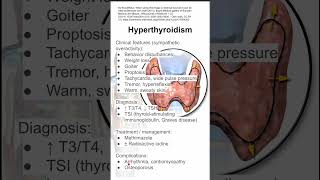 Hyperthyroidism [upl. by Esital38]