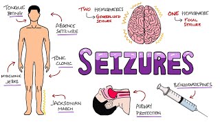 Seizures  Seizure Types  Generalized vs Focal Seizures  Causes of Seizures Mnemonic [upl. by Anippesuig332]